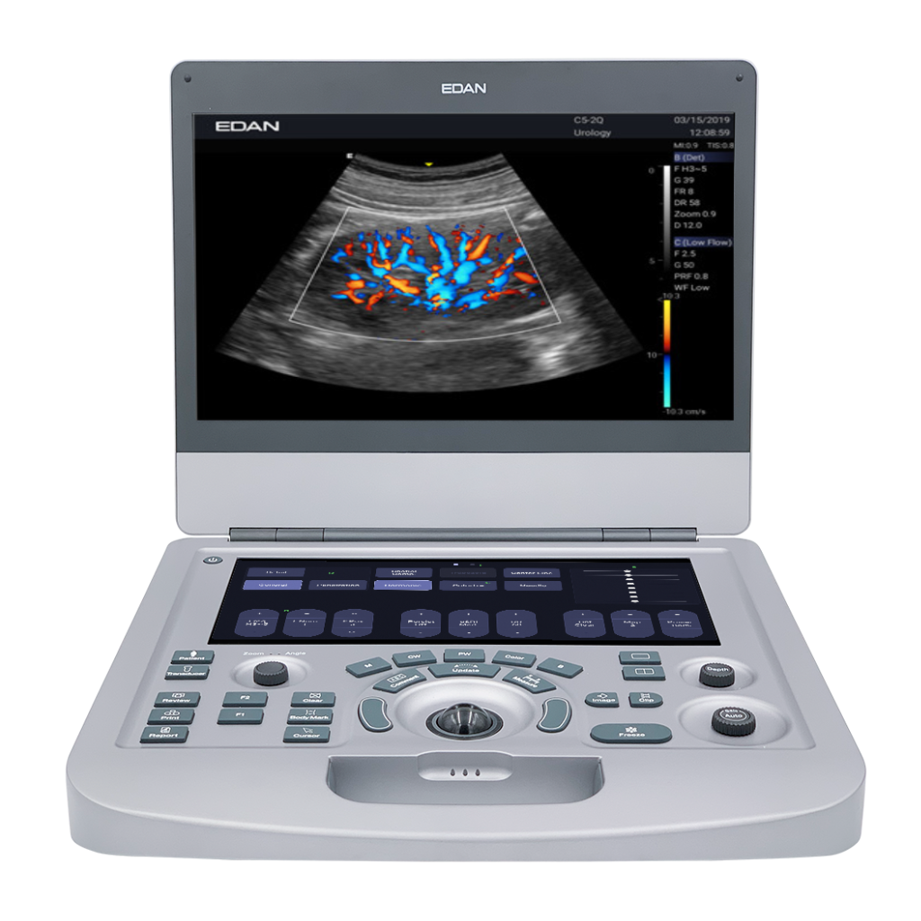 Edan Acclarix AX3 Compact Color Doppler Ultrasound System