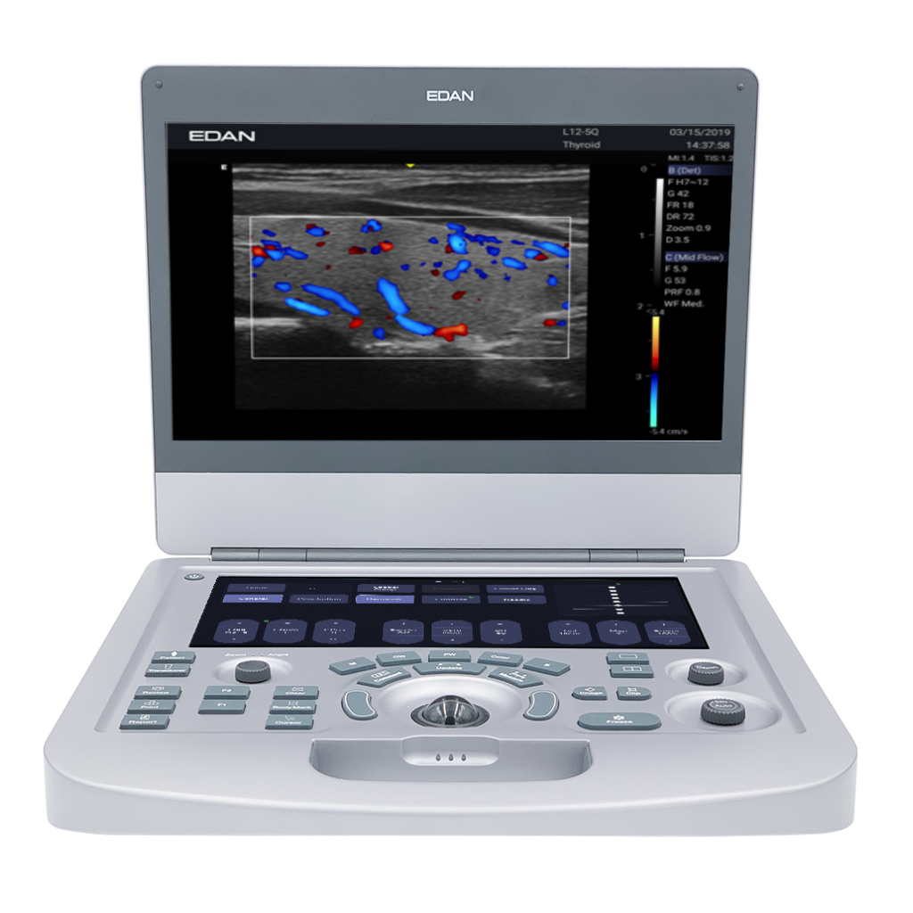 Edan Acclarix AX3 Compact Color Doppler Ultrasound System - Image 4