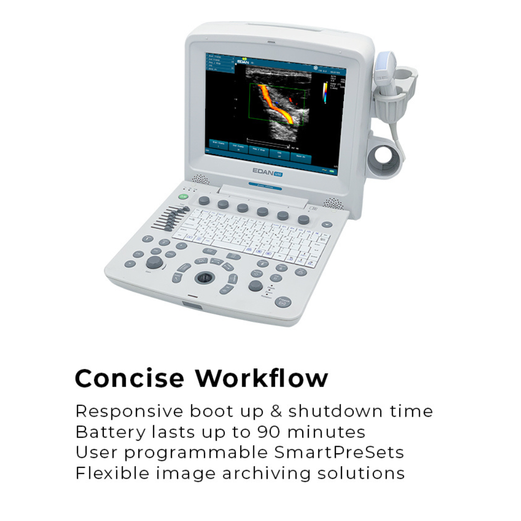 Edan U50 Diagnostic Ultrasound System - Image 2