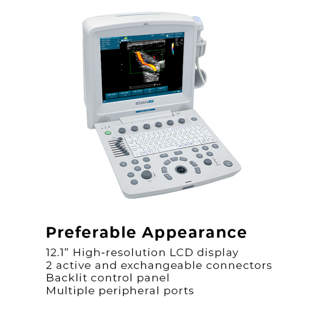 Edan U50 Diagnostic Ultrasound System - Image 3