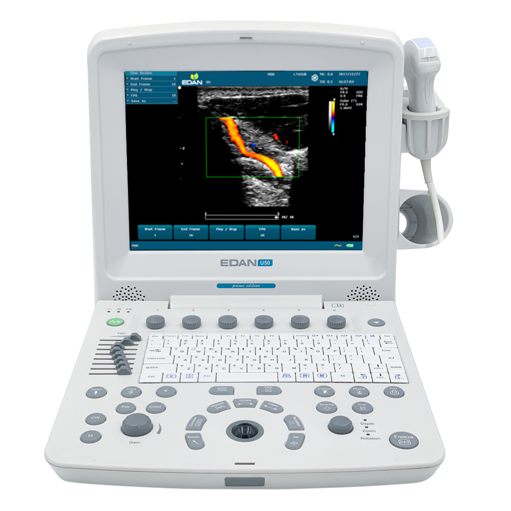 Edan U50 Diagnostic Ultrasound System