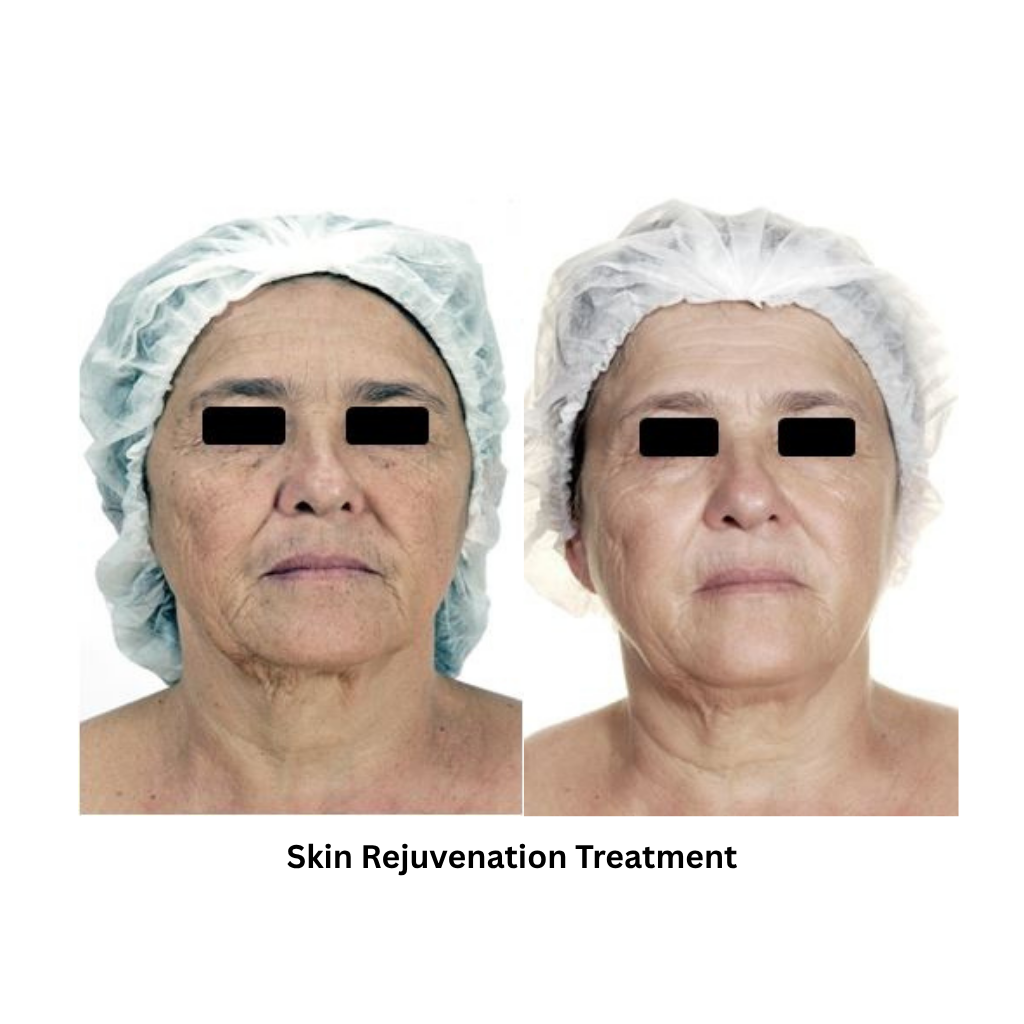 Extra 818 Hair Removal & Facial Treatment System - Image 7