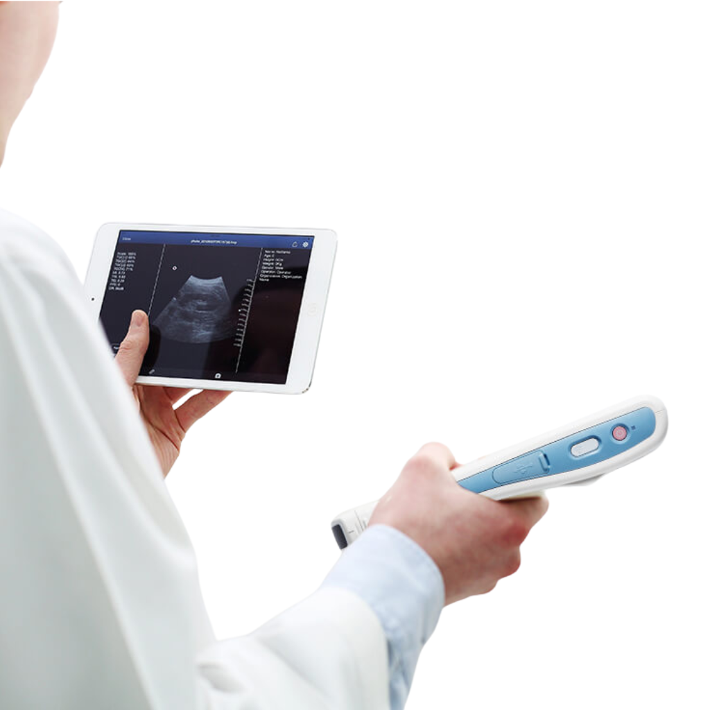 Healcerion SONON Convex Handheld Ultrasound (300C) - Image 5