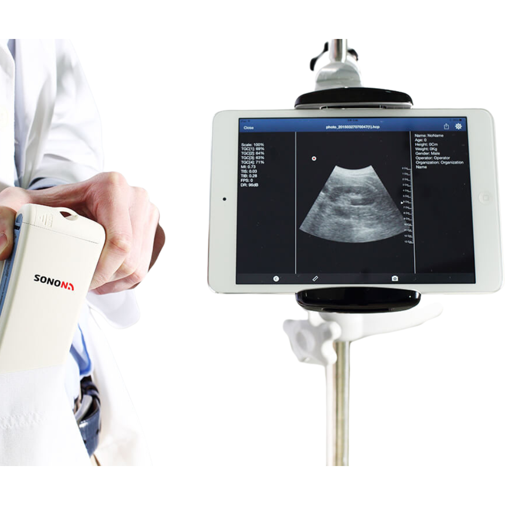 Healcerion SONON Convex Handheld Ultrasound (300C) - Image 6